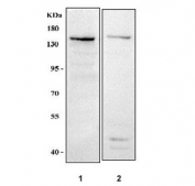 Western blot testing of 1) human A431 and 2) mouse brain tissue lysate with MYO6 antibody. Predicted molecular weight: 145-150 kDa (multiple isoforms).