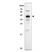 Western blot testing of rat kidney tissue with Kallikrein 7 antibody. Predicted molecular weight ~29 kDa but may be observed at higher molecular weights due to glycosylation.