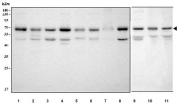 Western blot testing of 1) human HeLa, 2) human Jurkat, 3) human PC-3, 4) human 293T, 5) monkey COS-7, 6) human HEL, 7) human U-2 OS, 8) human SH-SY5Y, 9) rat C6, 10) mouse thymus and 11) mouse NIH 3T3 cell lysate with TR4 antibody. Predicted molecular weight: 65-67 kDa (two isoforms).