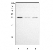 Western blot testing of human 1) HeLa, 2) A549 and 3) HepG2 cell lysate with NQO2 antibody. Predicted molecular weight ~26 kDa.