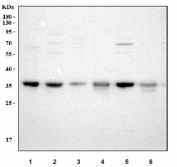 Western blot testing of human 1) 293T, 2) HeLa, 3) K562, 4) MCF7, 5) HepG2 and 6) A549 cell lysate with NTH1 antibody. Predicted molecular weight ~34 kDa (multiple isoforms).