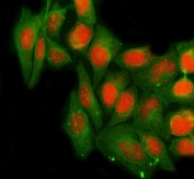 Immunofluorescent staining of FFPE human A549 cells with NTH1 antibody (red) and Beta Tubulin mAb (green). HIER: steam section in pH6 citrate buffer for 20 min.