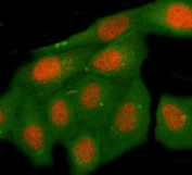 Immunofluorescent staining of FFPE human HeLa cells with Max-binding protein MNT antibody (red) and Beta Tubulin mAb (green). HIER: steam section in pH6 citrate buffer for 20 min.