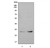 Western blot testing of human 1) HepG2 and 2) K562 cell lysate with MMACHC antibody. Predicted molecular weight ~32 kDa.
