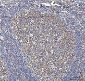 IHC staining of FFPE human tonsil tissue with METAP2 antibody. HIER: boil tissue sections in pH8 EDTA for 20 min and allow to cool before testing.