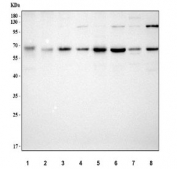 Western blot testing of 1) rat pancreas, 2) rat testis, 3) rat brain, 4) rat PC-12, 5) mouse pancreas, 6) mouse testis, 7) mouse brain and 8) mouse L929 cell lysate with METAP2 antibody. Predicted molecular weight: 50-53 kDa but may be observed at higher molecular weights due to glycosylation.