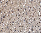 IHC staining of FFPE human brain tissue with METAP2 antibody. HIER: boil tissue sections in pH8 EDTA for 20 min and allow to cool before testing.
