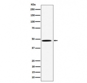 Western blot testing of human HeLa cell lysate with P4HTM antibody. Predicted molecular weight: 47-63 kDa (three isoforms).