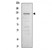 Western blot testing of human K562 cell lysate with NCX1 antibody. Predicted molecular weight: 105-108 kDa (multiple isoforms) but may be observed at higher molecular weights due to glycosylation.