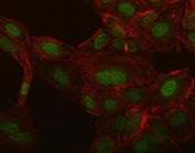 Immunofluorescent staining of FFPE human U-2 OS cells with NCX1 antibody (green) and Phalloidin (red). HIER: steam section in pH6 citrate buffer for 20 min.