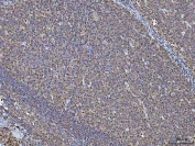 IHC staining of FFPE human tonsil tissue with NSUN2 antibody. HIER: boil tissue sections in pH8 EDTA for 20 min and allow to cool before testing.