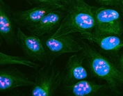 Immunofluorescent staining of FFPE human U-2 OS cells with Nucleolar protein 2 antibody (red), Beta Tubulin mAb (green) and DAPI nuclear stain (blue). HIER: steam section in pH6 citrate buffer for 20 min.