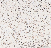 IHC staining of FFPE human rat brain tissue with NUCKS1 antibody. HIER: boil tissue sections in pH8 EDTA for 20 min and allow to cool before testing.