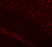 Immunofluorescent staining of FFPE mouse brain tissue with NUCKS1 antibody (red). HIER: steam section in pH8 EDTA buffer for 20 min.