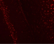 Immunofluorescent staining of FFPE rat brain tissue with NUCKS1 antibody (red). HIER: steam section in pH8 EDTA buffer for 20 min.