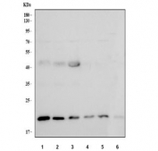 Western blot testing of 1) human 293T, 2) human SH-SY5Y, 3) human MCF7, 4) human A431, 5) rat liver and 6) mouse liver tissue lysate with NUCKS1 antibody. Predicted molecular weight ~23 kDa, ~27 kDa (two isoforms).