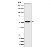 Western blot testing of human HepG2 cell lysate with HNF4A antibody. Predicted molecular weight ~50 kDa.