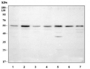 Western blot testing of 1) human HeLa, 2) human 293T, 3) human Jurkat, 4) rat thymus, 5) rat PC-12, 6) mouse thymus and 7) mouse NIH 3T3 cell lysate with NAP1L1 antibody. Predicted molecular weight: 37-45 kDa (three isoforms).