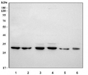 Western blot testing of human 1) 293T, 2) MCF7, 3) A549, 4) K562, 5) ThP-1 and 6) PC-3 cell lysate with Alpha SNAP antibody. Predicted molecular weight ~33 kDa.