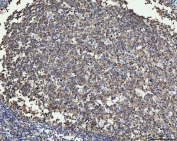 IHC staining of FFPE human tonsil tissue with MMP19 antibody. HIER: boil tissue sections in pH8 EDTA for 20 min and allow to cool before testing.