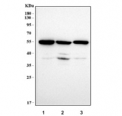 Western blot testing of human 1) SH-SY5Y, 2) 293T and 3) HeLa cell lysate with MMP19 antibody. Predicted molecular weight ~57 kDa.