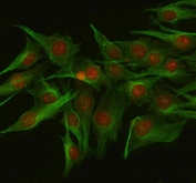 Immunofluorescent staining of FFPE rat C6 cells with NUP133 antibody (red) and Beta Tubulin mAb (green). HIER: steam section in pH6 citrate buffer for 20 min.