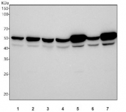 Western blot testing of 1) human Jurkat, 2) human SH-SY5Y, 3) human U-87 MG, 4) human U-251, 5) rat brain, 6) rat C6 and 7) mouse brain tissue lysate with P2Y Purinoceptor 12 antibody. Predicted molecular weight ~39 kDa but may be observed at higher molecular weights due to glycosylation.
