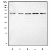 Western blot testing of human 1) Jurkat, 2) Caco-2, 3) SiHa, 4) K562 and 5) HeLa cell lysate with MED17 antibody. Predicted molecular weight ~73 kDa, commonly observed at 73-80 kDa.