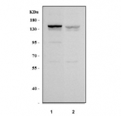 Western blot testing of human 1) K562 and 2) SiHa cell lysate with Nardilysin antibody. Predicted molecular weight ~132 kDa.