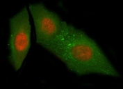 Immunofluorescent staining of FFPE human HeLa cells with NUB1 antibody (red) and Beta Tubulin mAb (green). HIER: steam section in pH6 citrate buffer for 20 min.