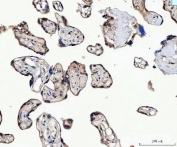 IHC staining of FFPE human placental tissue with MMS19 antibody. HIER: boil tissue sections in pH8 EDTA for 20 min and allow to cool before testing.