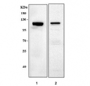 Western blot testing of 1) human Caco-2 and 2) mouse brain tissue lysate with MMS19 antibody. Predicted molecular weight ~113 kDa (multiple isoforms).