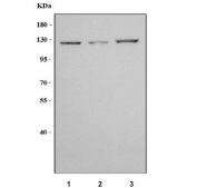 Western blot testing of human 1) A549, 2) HeLa and 3) K562 cell lysate with NAT10 antibody. Predicted molecular weight ~116 kDa.