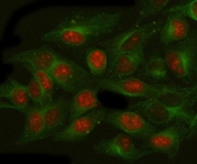 Immunofluorescent staining of FFPE human HeLa cells with NAT10 antibody (red) and Beta Tubulin mAb (green). HIER: steam section in pH6 citrate buffer for 20 min.