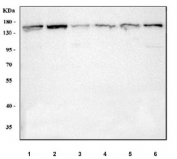 Western blot testing of human 1) 293T, 2) HeLa, 3) Jurkat, 4) SiHa, 5) K562 and 6) A431 cell lysate with Nucleoporin 155 antibody. Predicted molecular weight ~155 kDa.