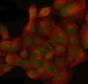 Immunofluorescent staining of FFPE human A549 cells with Nucleoporin 155 antibody (green) and Beta Tubulin mAb (red). HIER: steam section in pH6 citrate buffer for 20 min.