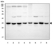 Western blot testing of 1) human A431, 2) human HeLa, 3) human A375, 4) human MCF7, 5) rat testis, 6) rat RH35, 7) mouse testis and 8) mouse NIH 3T3 cell lysate with MNAT1 antibody. Expected molecular weight ~36 kDa.