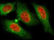 Immunofluorescent staining of FFPE human HeLa cells with MNAT1 antibody (red) and Beta Tubulin mAb (green). HIER: steam section in pH6 citrate buffer for 20 min.