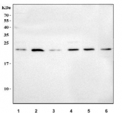 Western blot testing of 1) human A549, 2) human SiHa, 3) human ThP-1, 4) human U-251, 5) rat testis and 6) mouse testis tissue lysate with MSRB3 antibody. Predicted molecular weight ~21 kDa.