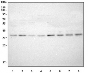 Western blot testing of human 1) A431, 2) K562, 3) HeLa, 4) ThP-1, 5) HepG2, 6) HEL, 7) 293T and 8) SH-SY5Y cell lysate with MAD2L1BP antibody. Predicted molecular weight: 31-35 kDa (two isoforms).