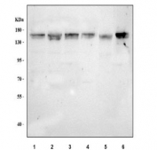 Western blot testing of 1) human 293T, 2) human MCF7, 3) human RT4, 4) human SH-SY5Y, 5) rat brain and 6) mouse brain tissue lysate with ASPP1 antibody. Predicted molecular weight ~120 kDa.