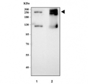Western blot testing of 1) rat small intestine and 2) mouse small intestine tissue lysate with Maltase-glucoamylase antibody. Predicted molecular weight ~210 kDa and ~312 kDa (two isoforms) but may be observed at higher molecular weights due to glycosylation.