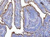 IHC staining of FFPE rat colon tissue with Maltase-glucoamylase antibody. HIER: boil tissue sections in pH8 EDTA for 20 min and allow to cool before testing.