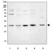 Western blot testing of 1) human HeLa, 2) human 293T, 3) human HepG2, 4) human Jurkat and 5) rat RH35 cell lysate with NUDT5 antibody. Predicted molecular weight ~35 kDa.