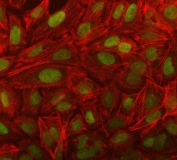 Immunofluorescent staining of FFPE human U-2 OS cells with NOSIP antibody (green) and Phalloidin (red). HIER: steam section in pH6 citrate buffer for 20 min.