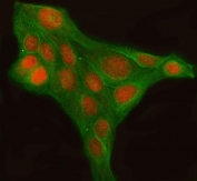 Immunofluorescent staining of FFPE human U-2 OS cells with LHX6 antibody (red) and Beta Tubulin mAb (green). HIER: steam section in pH6 citrate buffer for 20 min.