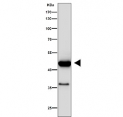 Western blot testing of human SK-BR-3 cell lysate with Keratin 19 antibody. Predicted molecular weight ~43 kDa.