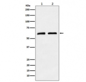 Western blot testing of 1) human A673 and 2) mouse brain tissue lysate with Caseinolytic protease X antibody. Predicted molecular weight ~69 kDa.