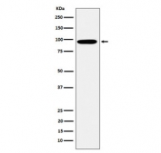 Western blot testing of human K562 cell lysate with EPN1 antibody. Predicted molecular weight: 58-69 kDa (multiple isoforms).