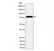 Western blot testing of human MCF7 cell lysate with GFAT antibody. Predicted molecular weight ~79 kDa.